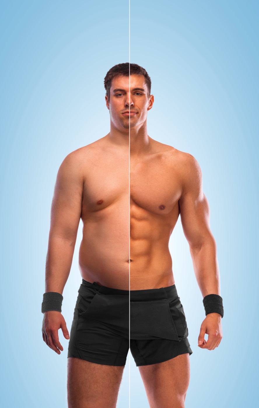 Fat Reduction: Cryolipolysis and Non-Surgical Fat Reduction