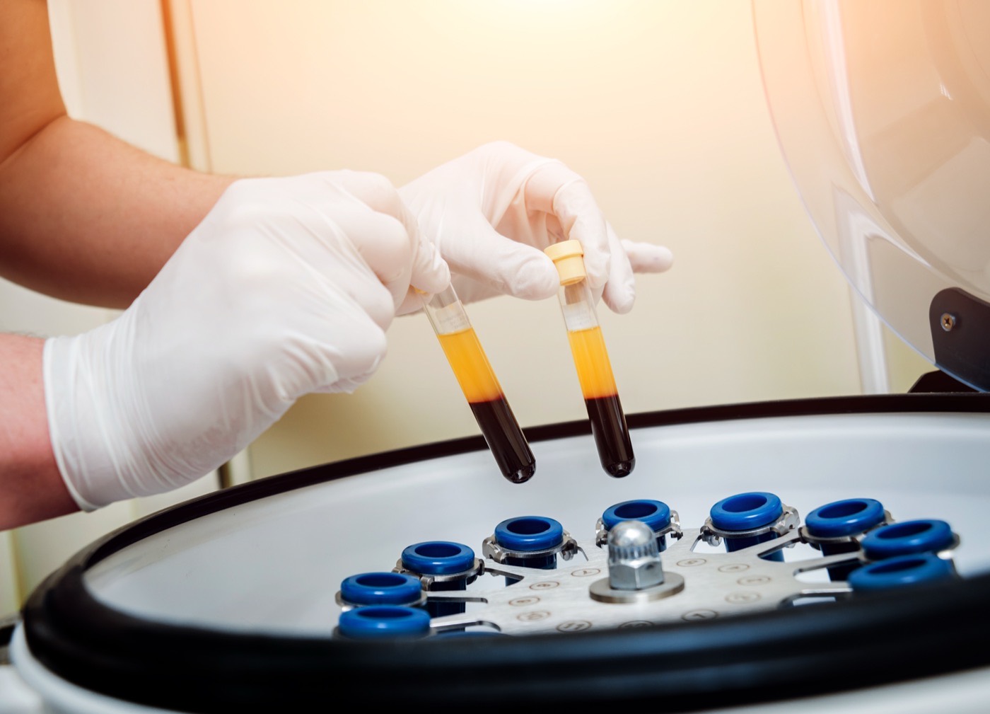 The P-Shot: A Revolutionary Treatment for Male Enhancement and Erectile Dysfunction