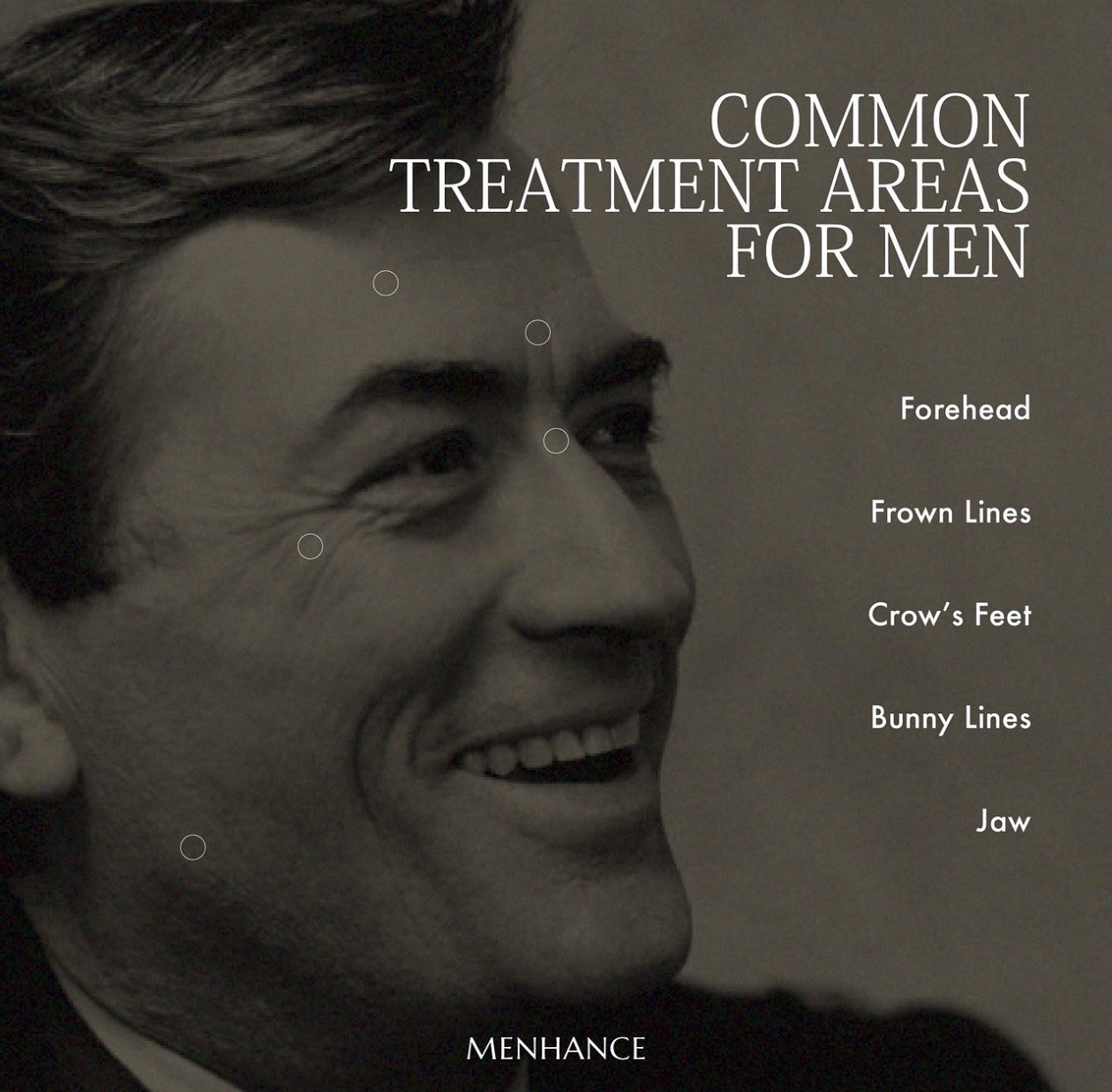 Brotox &mdash; common botulinum treatment areas for men